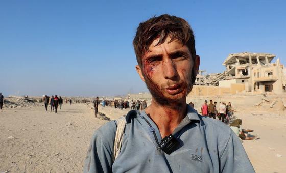 Hospitais em Gaza sobrecarregados com feridos em áreas de distribuição de comida